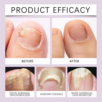 Nailorish™️ Nail Treatment Serum (Pack of 2)